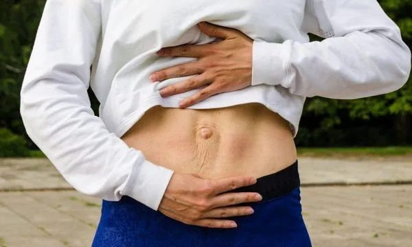 Diástasis Abdominal