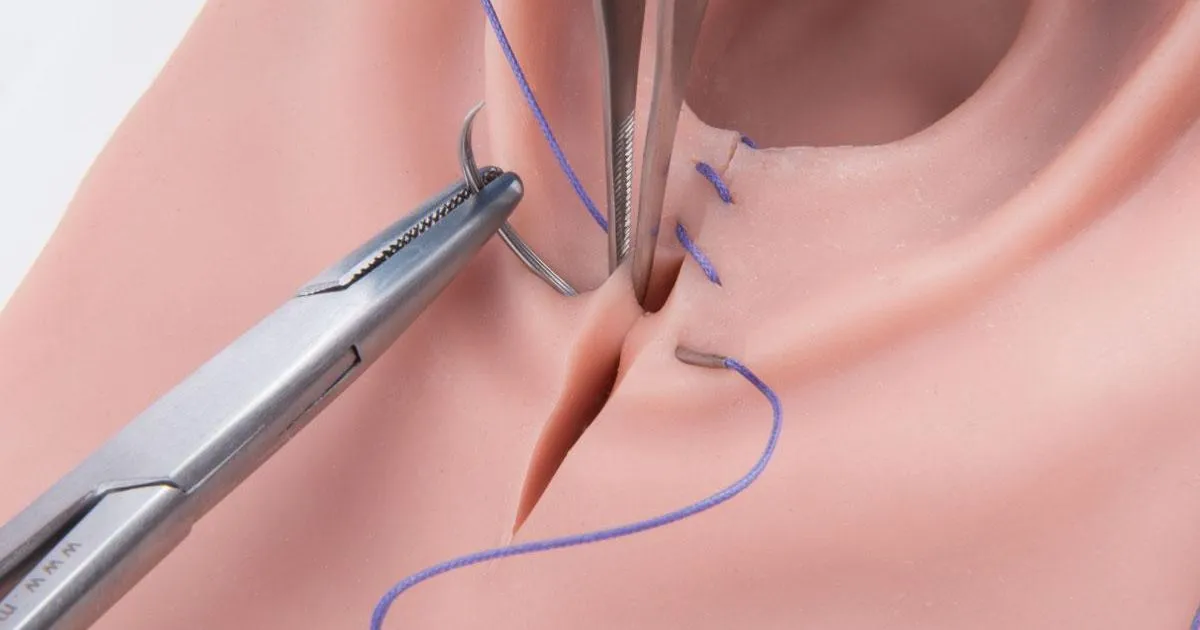 Episiotomía y Desgarro Perineal