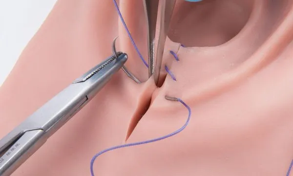 Episiotomía y Desgarro Perineal